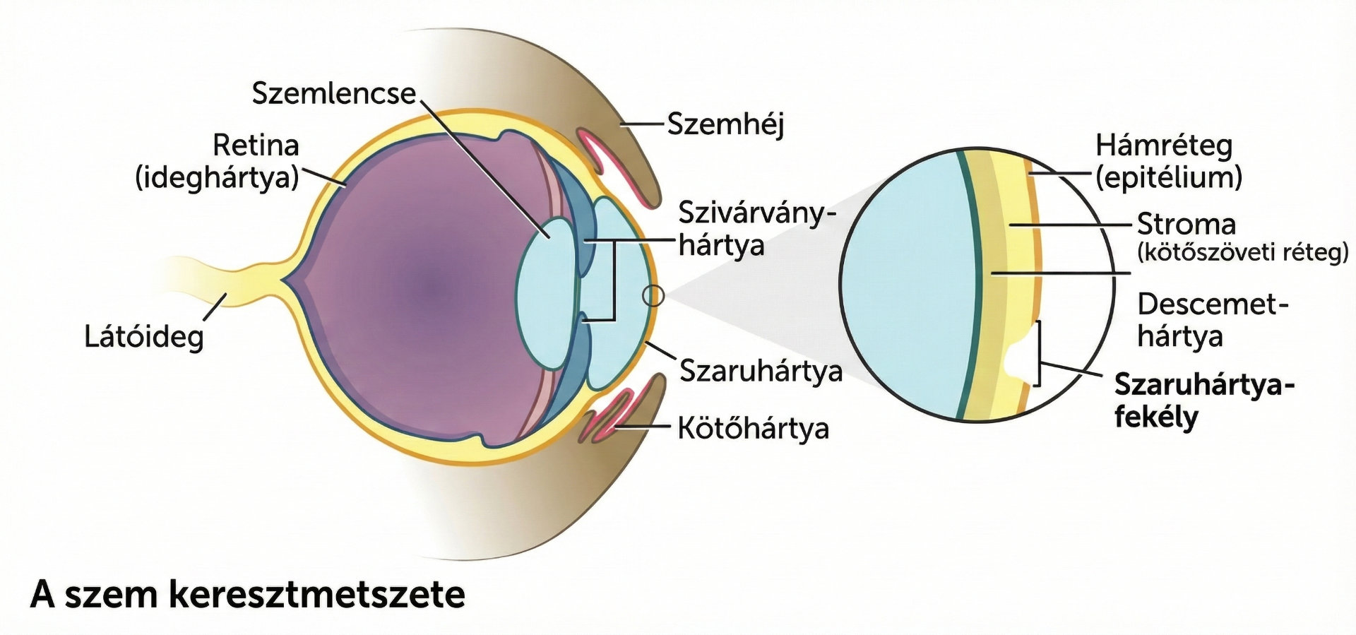 Szaruhártya disztrófia