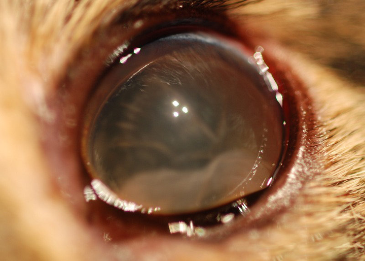 Elülső lencseficam